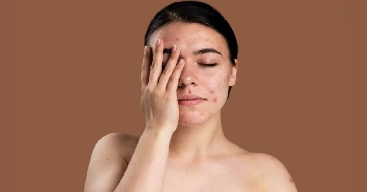 how-climate-change-is-revolutionizing-skincare-for-urba