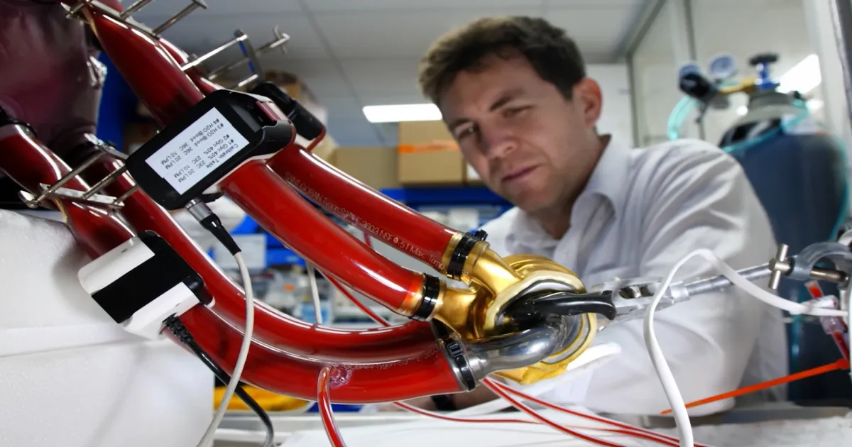 A Medical Miracle! Australian Man Sets World Record with Artificial Heart, Lives 105 Days