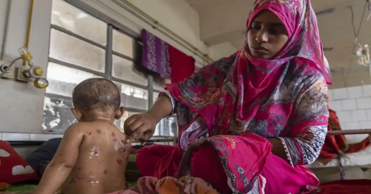 Bangladesh Faces Deadly Measles Crisis As Vaccine Coverage Collapses