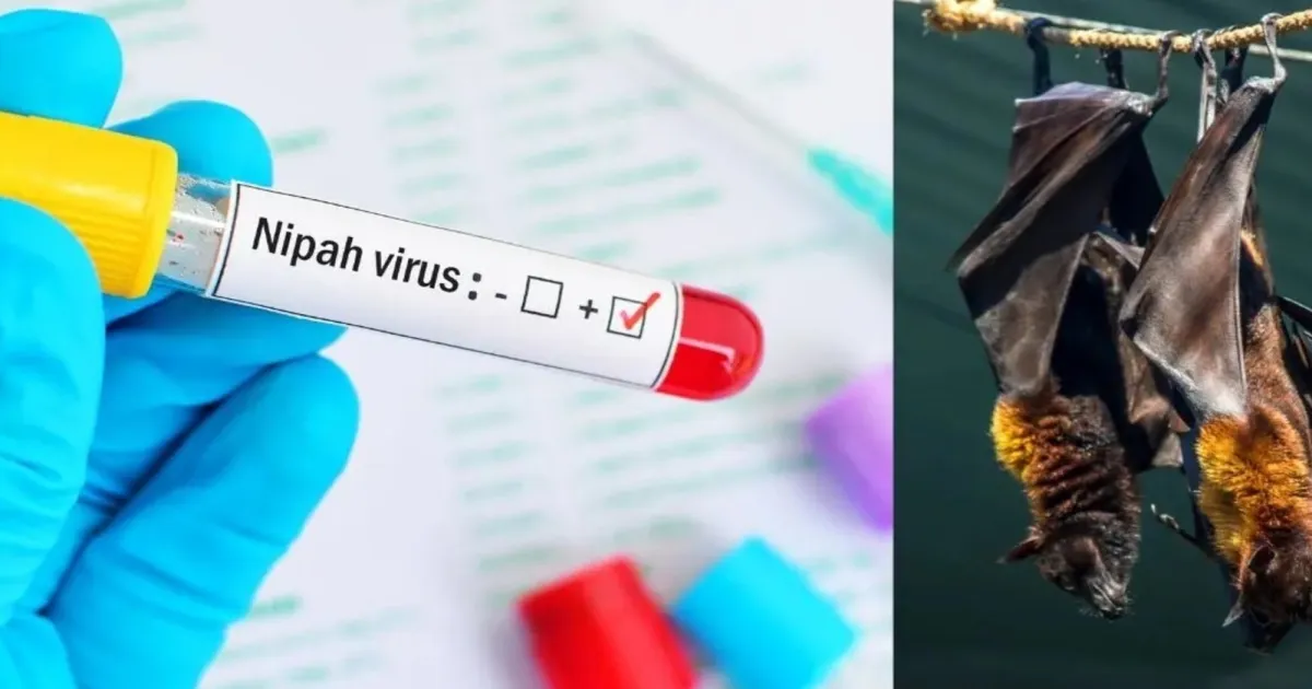 New Bat Virus Found in Bangladesh Patients with Nipah-Like Symptoms
