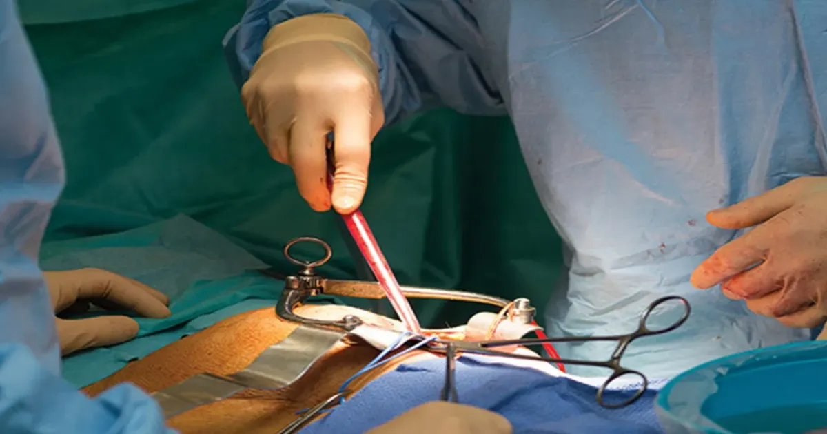 Kidney Racket Roils Tamil Nadu! Six Victims Identified