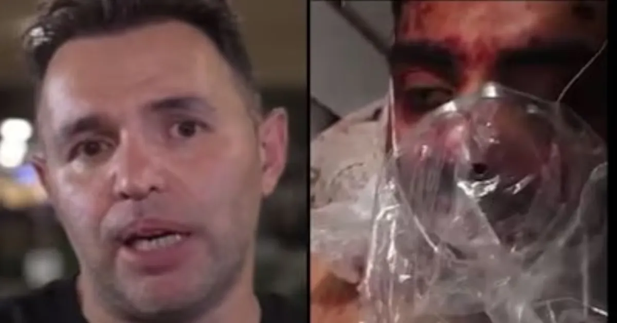 Dentist Treating Indian Pilot Recalls Severe Head And Hand Injuries After Flydubai Incident