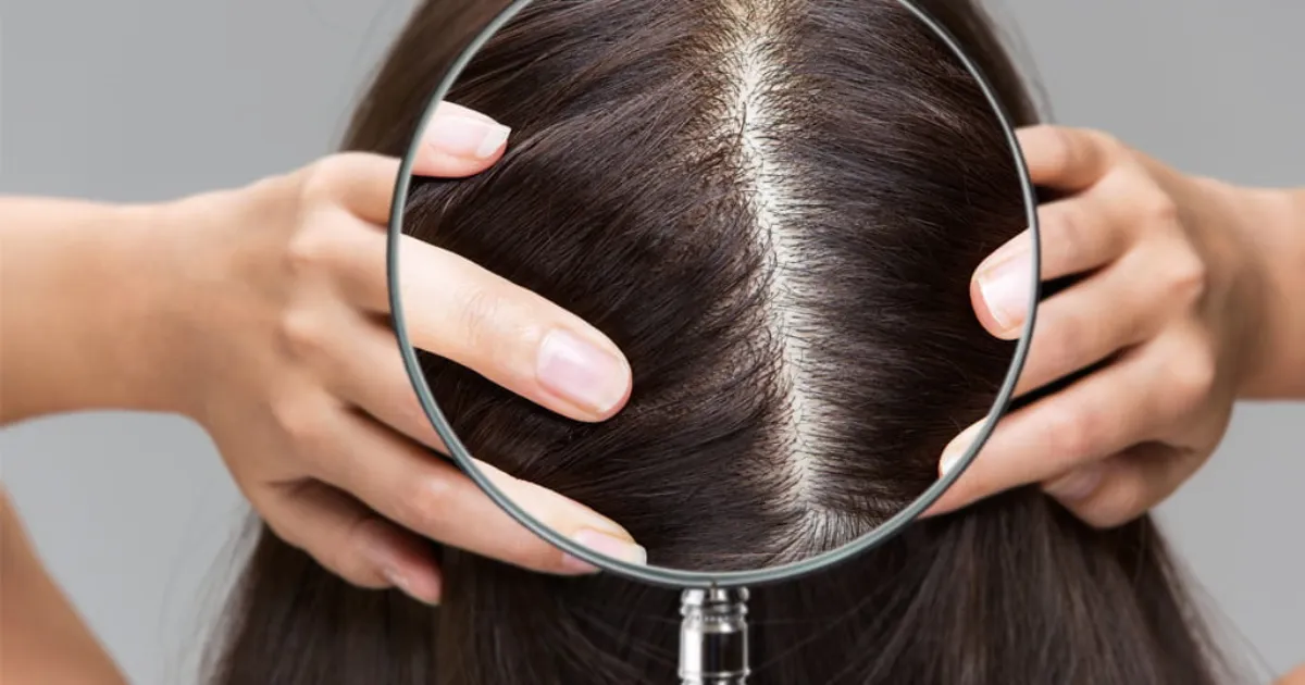 struggling-with-hair-loss-experts-say-youre-ignoring-th