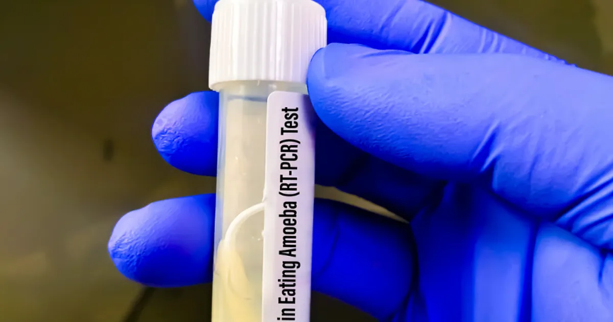 Rare Brain Fever Claims Two More Lives in Kerala