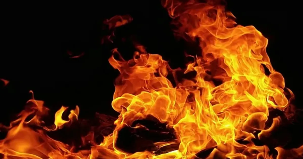 Mumbai Shop Blaze Leaves Victims With Severe, Life-Threatening Burns