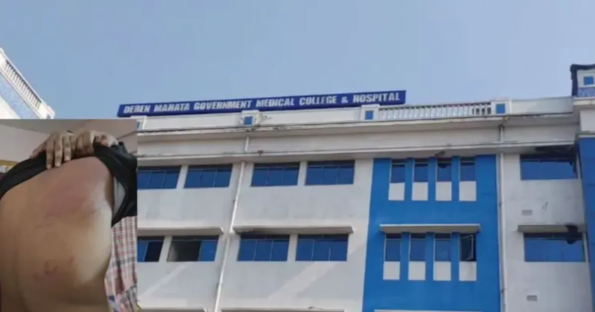 First-Year Student Suffers Massive Bruises as Ragging Sparks Outrage