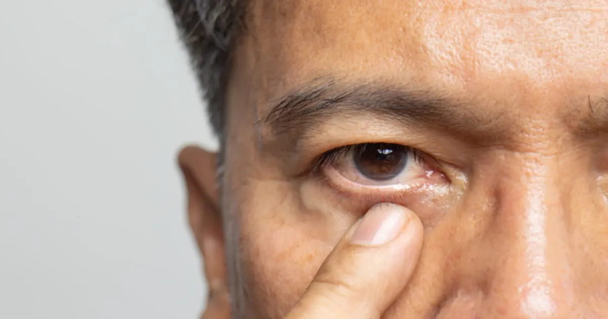 Superstition Over Eye Twitch Leaves Chinese Man With Damaged Vision
