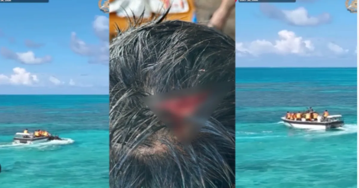 Chinese Coast Guard Injures Filipino Sailor In South China Sea Incident