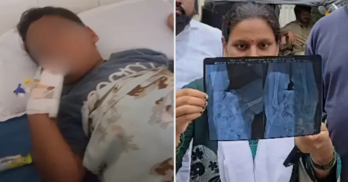 Thane Hospital Sends Toddler Home With Broken Needle in Body