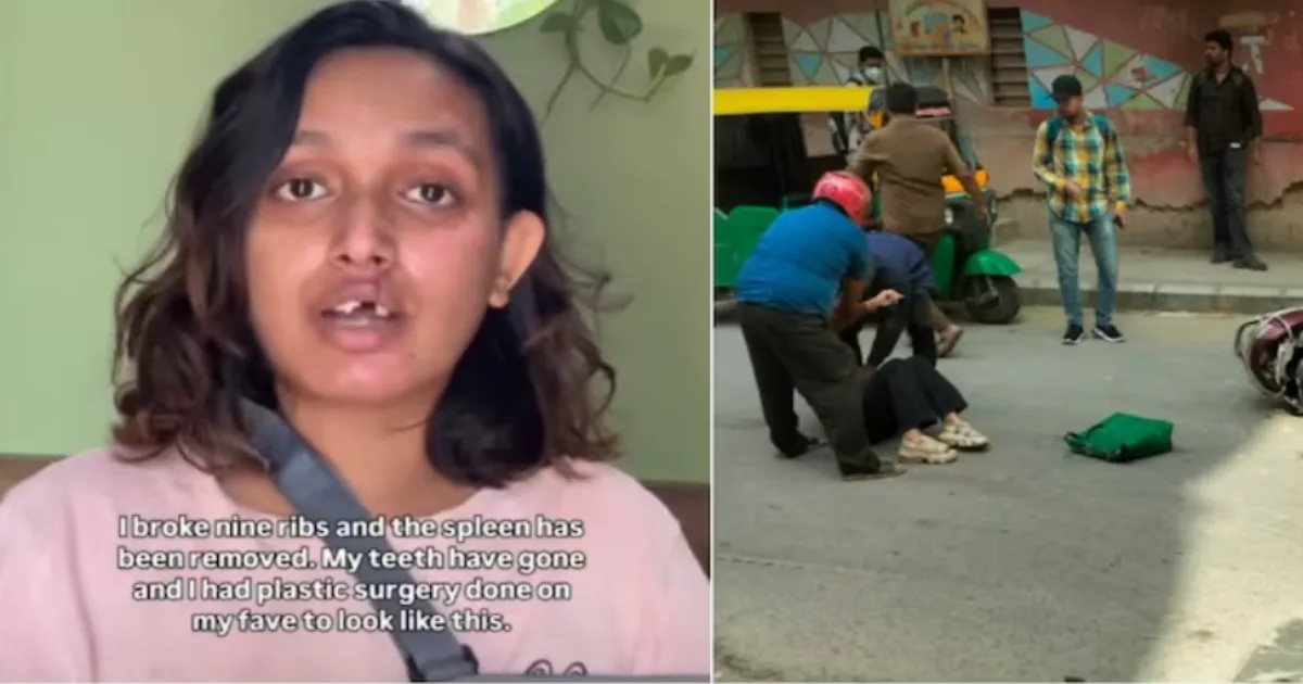 Bengaluru Woman Critically Injured in Rapido Bike Accident, Alleges Inadequate Support