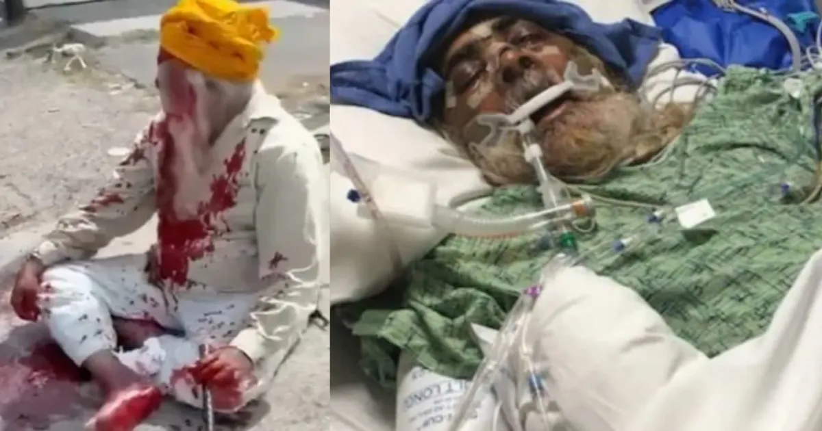 Elderly Sikh Man Attacked in LA Gurdwara Assault