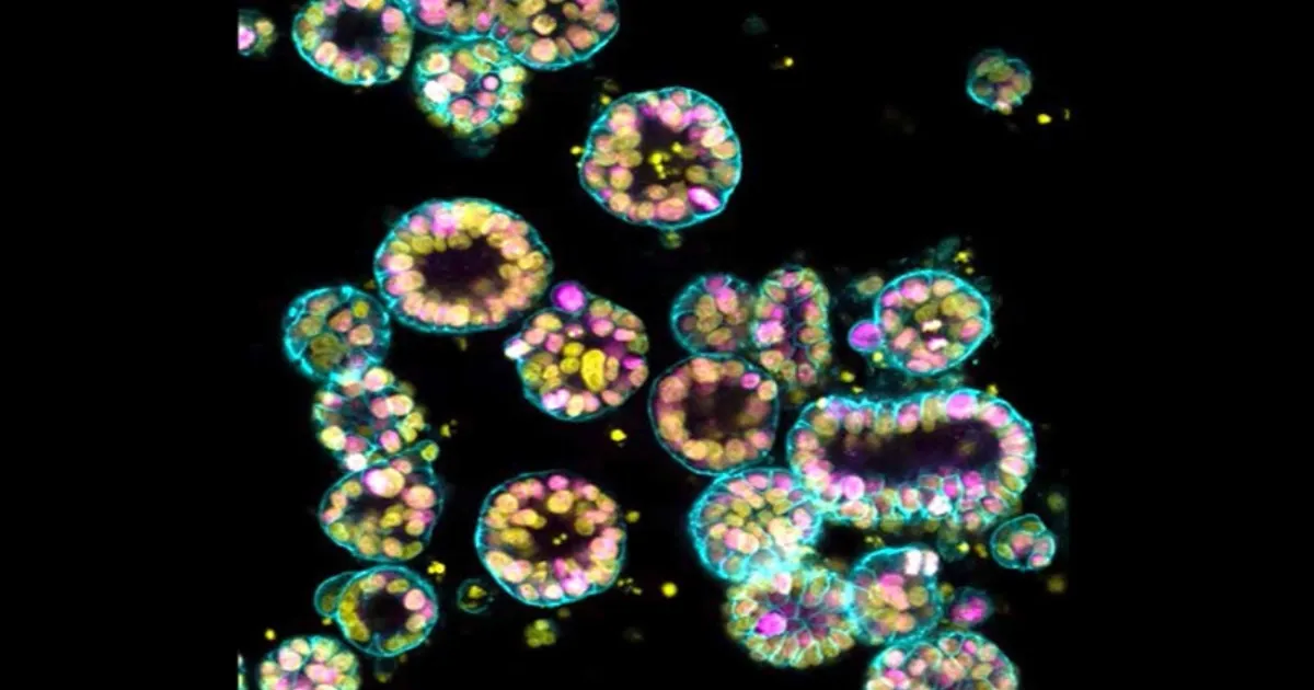 Are Chemicals Fueling Cancer in the Young?