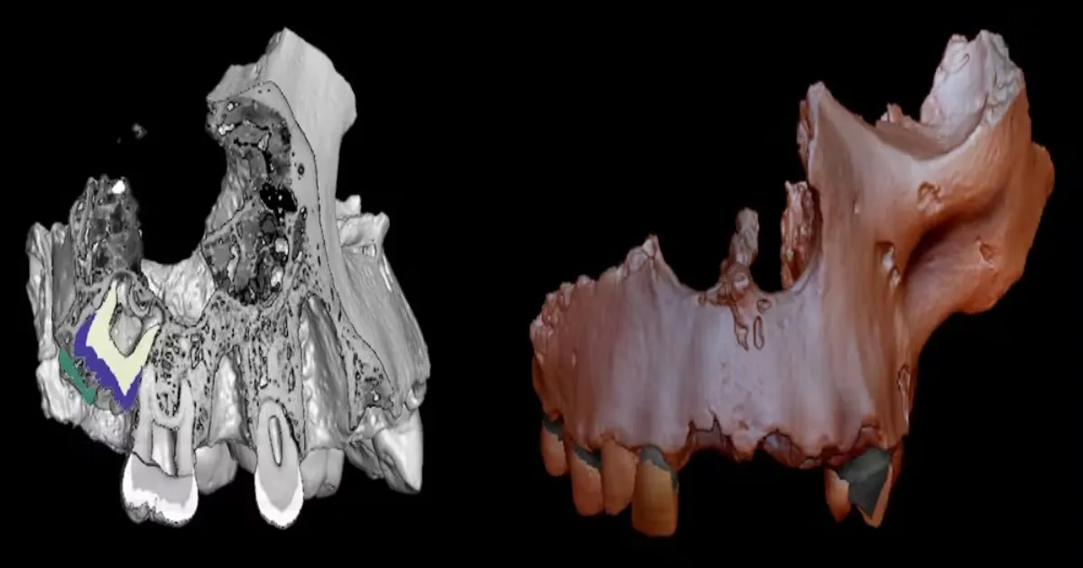 micro-ct-scans-may-harm-fossils-study-warns