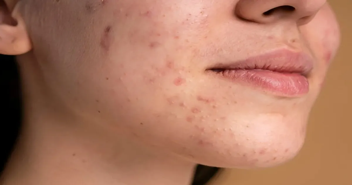 pigmentation-isnt-just-skin-deeplovneet-batra-reveals-w
