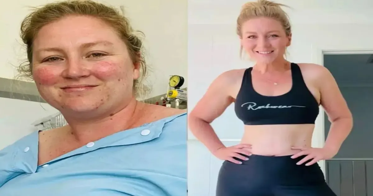 Woman Who Lost 70 Kg Reveals the Easiest Weight Loss Exercise You Can Do Anywhere