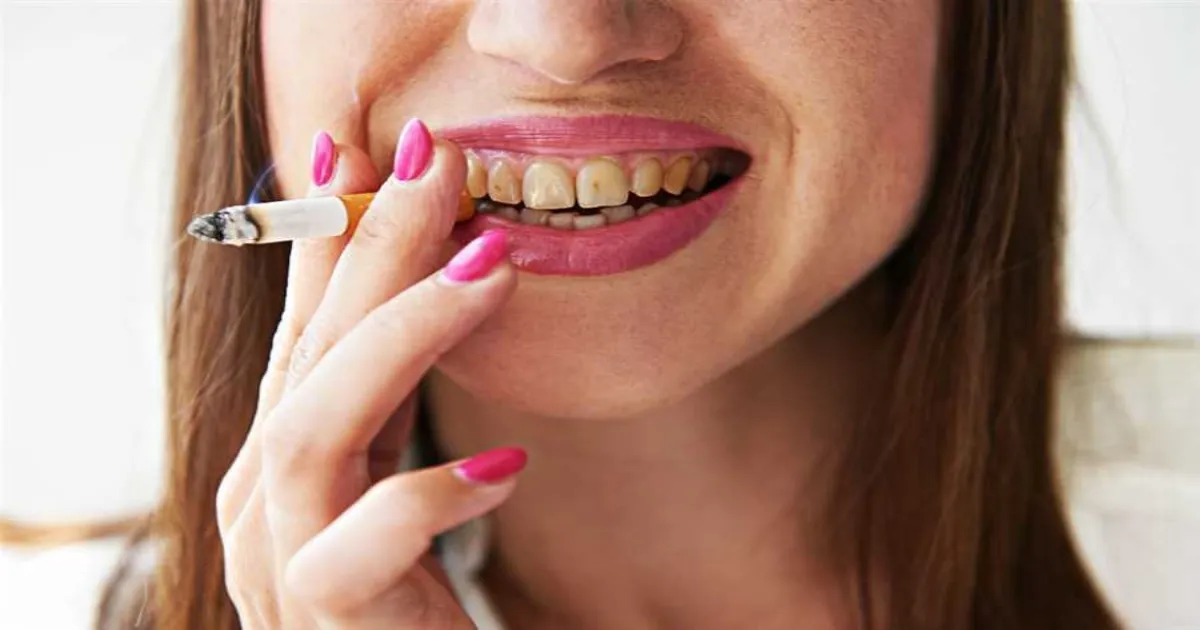 smoking-is-silently-wrecking-your-teeth-and-gumsdentist