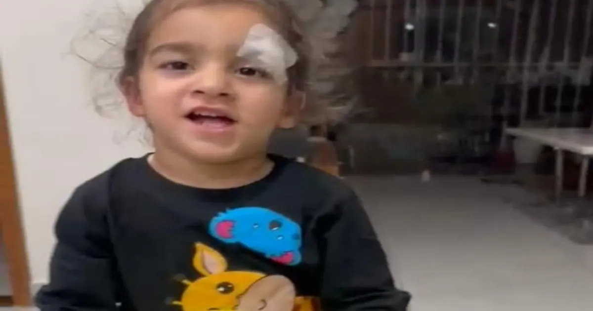 UP Doctor’s Unusual Act: Uses Feviquick Instead of Stitches on Toddler’s Severe Eye Wound