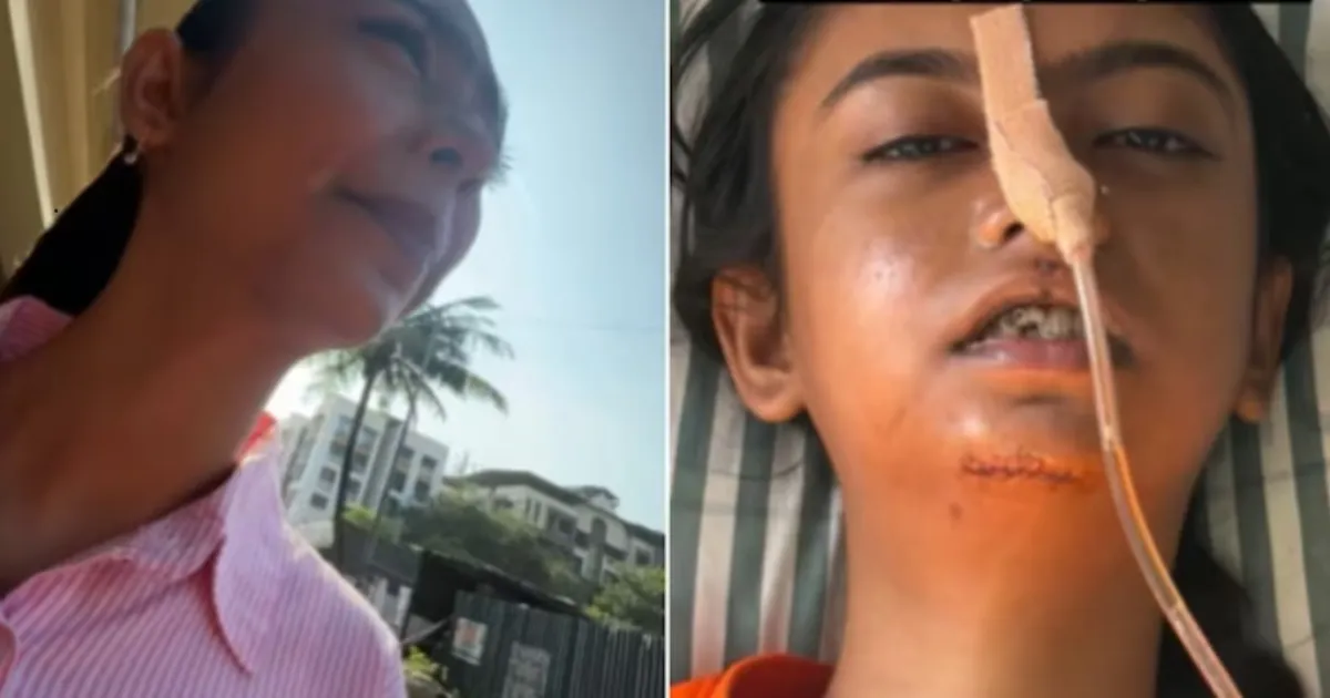 Mumbai YouTuber’s Jaw-Shattering Rapido Crash Reveals Bike Taxi Safety Gaps