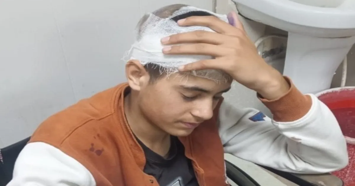 17-Year-Old Kashmiri Shawl Seller Beaten With Iron Rods in Uttarakhand