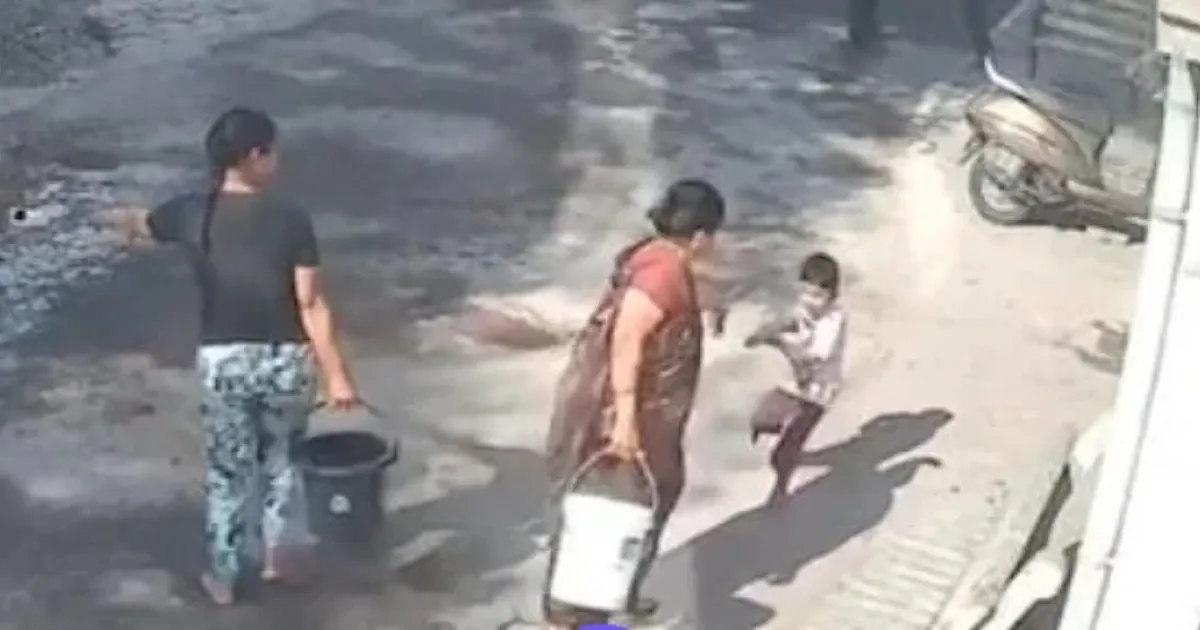Four-Year-Old Hospitalised After Nagpur Grandmother Pours Hot Water