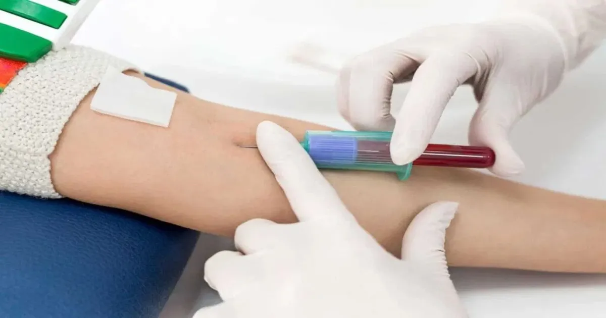 Imperial College Researchers Develop VeloCD Test To Predict Illness Progression
