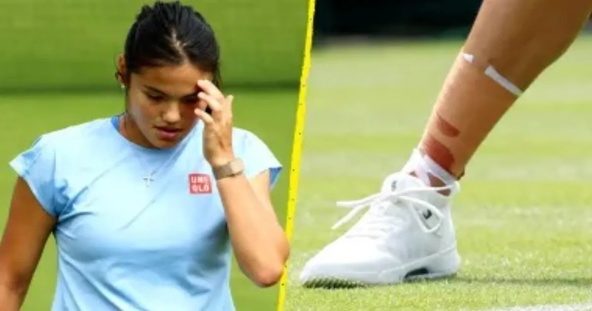 Emma Raducanu Withdraws With Leg Injury Ahead Of Wimbledon Championship Start