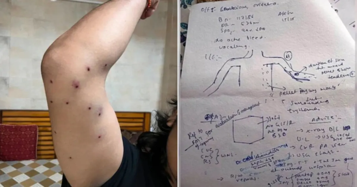 TMC, Opposition To Raise Student Pellet Gun Allegations During Parliament Session