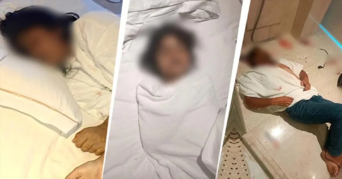 Bengaluru Police Investigate Deaths Of Two Children At Five-Star Hotel