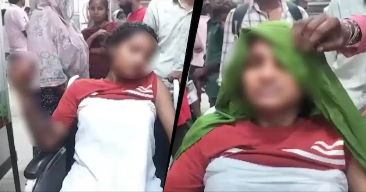 Faridabad Woman Hospitalised With Severe Burns After Alleged Boiling Water Assault