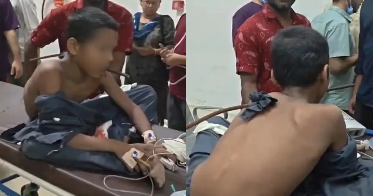 Surat Boy, 13, Survives Construction Accident And Undergoes Emergency Surgery