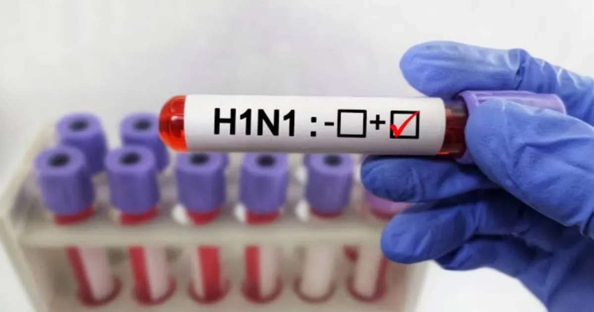 Nainital Reports Four H1N1 Deaths As Uttarakhand Sees 18 Positive Cases Amid Surge